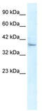 Kelch Like Family Member 14 antibody, TA337285, Origene, Western Blot image 