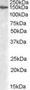 Mannosidase Alpha Class 2A Member 1 antibody, TA302533, Origene, Western Blot image 