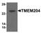 Transmembrane Protein 204 antibody, NBP1-77069, Novus Biologicals, Western Blot image 