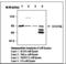 Signal Transducer And Activator Of Transcription 5B antibody, LS-C62230, Lifespan Biosciences, Western Blot image 