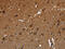 Fyn Related Src Family Tyrosine Kinase antibody, CSB-PA570140, Cusabio, Immunohistochemistry frozen image 