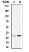 Serpin Family B Member 9 antibody, LS-C352660, Lifespan Biosciences, Western Blot image 