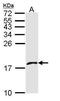Platelet Factor 4 Variant 1 antibody, PA5-21944, Invitrogen Antibodies, Western Blot image 