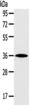 Homeobox D13 antibody, TA350693, Origene, Western Blot image 