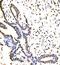 Vir Like M6A Methyltransferase Associated antibody, A32283-1, Boster Biological Technology, Immunohistochemistry paraffin image 