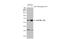 Sequestosome 1 antibody, GTX636328, GeneTex, Western Blot image 