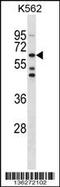 Testis Associated Actin Remodelling Kinase 1 antibody, 58-727, ProSci, Western Blot image 