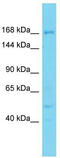 DExD/H-Box 60 Like antibody, TA332265, Origene, Western Blot image 