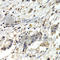 BUB1 Mitotic Checkpoint Serine/Threonine Kinase B antibody, A1775, ABclonal Technology, Immunohistochemistry paraffin image 