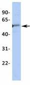 Potassium Voltage-Gated Channel Subfamily J Member 12 antibody, GTX47662, GeneTex, Western Blot image 