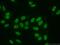 SWI/SNF Related, Matrix Associated, Actin Dependent Regulator Of Chromatin, Subfamily A, Member 5 antibody, 13066-1-AP, Proteintech Group, Immunofluorescence image 