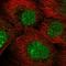 Major Facilitator Superfamily Domain Containing 1 antibody, HPA057924, Atlas Antibodies, Immunofluorescence image 