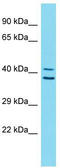 Zinc Finger Protein 414 antibody, TA329664, Origene, Western Blot image 