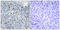 DNA Topoisomerase II Alpha antibody, LS-C199674, Lifespan Biosciences, Immunohistochemistry paraffin image 