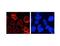 Nucleoporin 210 antibody, LS-C82246, Lifespan Biosciences, Immunocytochemistry image 