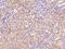 Rho GDP Dissociation Inhibitor Alpha antibody, GTX02256, GeneTex, Immunohistochemistry paraffin image 