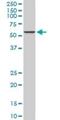 Calcium Voltage-Gated Channel Auxiliary Subunit Beta 2 antibody, H00000783-M01, Novus Biologicals, Western Blot image 