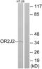 Olfactory Receptor Family 2 Subfamily J Member 2 antibody, abx015417, Abbexa, Western Blot image 