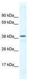 TOR antibody, TA332074, Origene, Western Blot image 