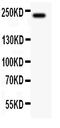 Mucin 4, Cell Surface Associated antibody, PB9147, Boster Biological Technology, Western Blot image 