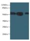 Inosine Monophosphate Dehydrogenase 2 antibody, LS-C375955, Lifespan Biosciences, Western Blot image 