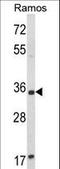 Aminoacylase 3 antibody, LS-C156027, Lifespan Biosciences, Western Blot image 