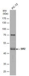 Sirtuin 2 antibody, GTX129154, GeneTex, Western Blot image 