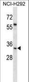 Uroplakin 1B antibody, LS-C160447, Lifespan Biosciences, Western Blot image 