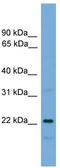 Nicotinamide Riboside Kinase 1 antibody, TA344957, Origene, Western Blot image 