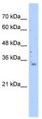 Mitochondrial Ribosomal Protein S15 antibody, TA333635, Origene, Western Blot image 