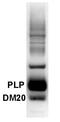 Proteolipid Protein 1 antibody, GTX79242, GeneTex, Western Blot image 