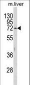 Hexosaminidase Subunit Alpha antibody, LS-B9894, Lifespan Biosciences, Western Blot image 