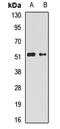 Gamma-Aminobutyric Acid Type A Receptor Alpha5 Subunit antibody, LS-C667806, Lifespan Biosciences, Western Blot image 