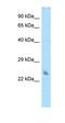 Hippocalcin Like 1 antibody, orb324751, Biorbyt, Western Blot image 