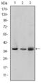 LIM Zinc Finger Domain Containing 1 antibody, STJ98322, St John