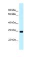 DNA Damage Regulated Autophagy Modulator 1 antibody, orb325347, Biorbyt, Western Blot image 