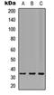 TNFRSF1A Associated Via Death Domain antibody, orb304646, Biorbyt, Western Blot image 