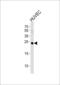 Casein Kinase 2 Beta antibody, 62-639, ProSci, Western Blot image 