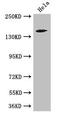 Trinucleotide Repeat Containing Adaptor 6C antibody, orb46527, Biorbyt, Western Blot image 