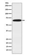 DEAD-Box Helicase 5 antibody, M00670, Boster Biological Technology, Western Blot image 