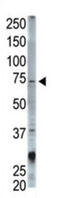 Signal Transducing Adaptor Molecule antibody, abx031568, Abbexa, Western Blot image 