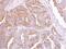 Pleckstrin Homology Domain Containing A5 antibody, NBP2-19770, Novus Biologicals, Immunohistochemistry paraffin image 
