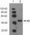Phosphoglycerate Kinase 1 antibody, LS-B14106, Lifespan Biosciences, Western Blot image 