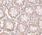 CD248 Molecule antibody, NBP1-77311, Novus Biologicals, Immunohistochemistry paraffin image 