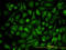 Vinculin antibody, LS-C198423, Lifespan Biosciences, Immunofluorescence image 