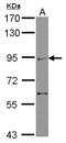 Zinc finger MIZ domain-containing protein 2 antibody, NBP2-20959, Novus Biologicals, Western Blot image 