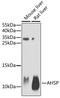 Alpha Hemoglobin Stabilizing Protein antibody, GTX30035, GeneTex, Western Blot image 