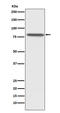 Prosaposin antibody, M00937, Boster Biological Technology, Western Blot image 