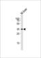 H6 Family Homeobox 2 antibody, GTX81571, GeneTex, Western Blot image 