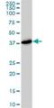 Proteasome 26S Subunit, Non-ATPase 7 antibody, H00005713-M01, Novus Biologicals, Western Blot image 